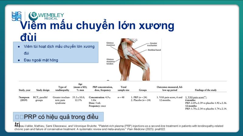 Presentation: Application of PRP in the Treatment of Tendinitis