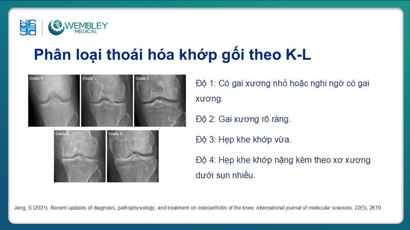 Bài báo cáo: Vai trò của PRP trong điều trị thoái hóa khớp
