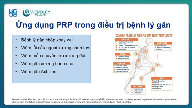 Presentation: Application of PRP in the Treatment of Tendinitis