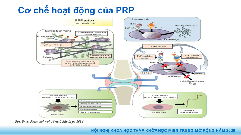 Presentation: Application of PRP in the Treatment of Tendinitis
