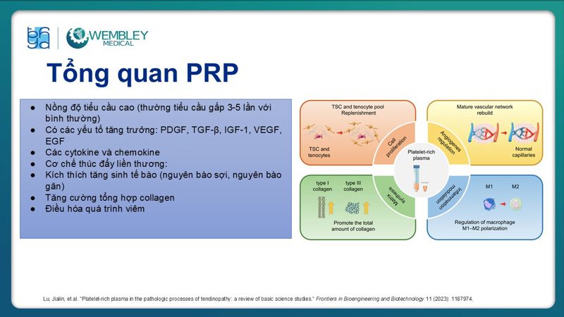 Presentation: Application of PRP in the Treatment of Tendinitis
