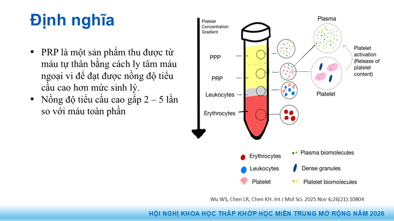 Presentation: Application of PRP in the Treatment of Tendinitis