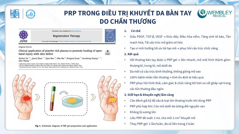 Bài báo cáo: Tối ưu hóa ứng dụng của PRP cho da ngoài vùng đầu - mặt