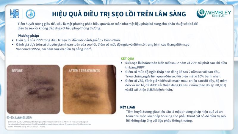 Bài báo cáo: Tối ưu hóa ứng dụng của PRP cho da ngoài vùng đầu - mặt