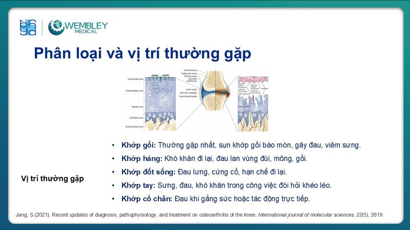 Bài báo cáo: Vai trò của PRP trong điều trị thoái hóa khớp