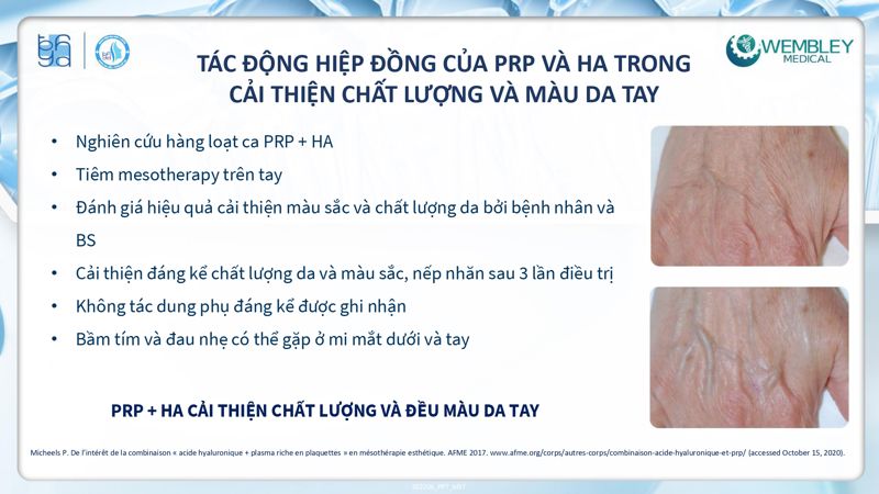 Bài báo cáo: Tối ưu hóa ứng dụng của PRP cho da ngoài vùng đầu - mặt