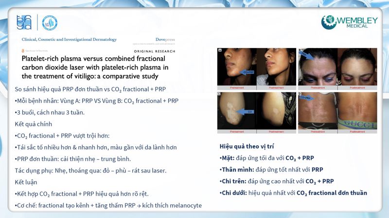 Bài báo cáo: Tối ưu hóa ứng dụng của PRP cho da ngoài vùng đầu - mặt