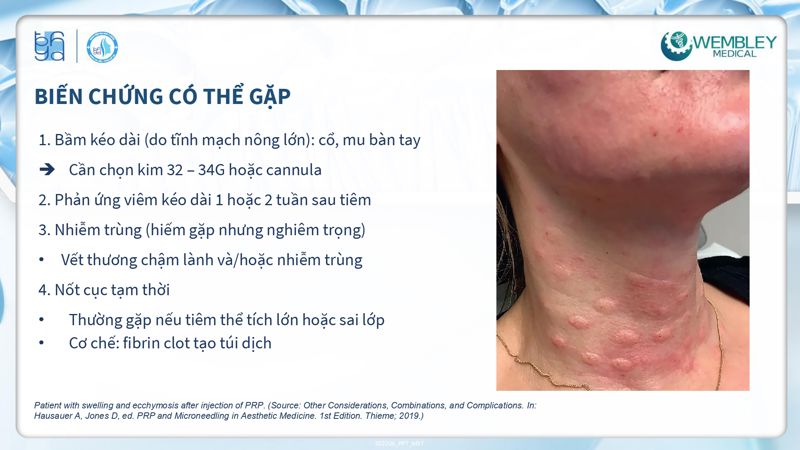 Bài báo cáo: Tối ưu hóa ứng dụng của PRP cho da ngoài vùng đầu - mặt