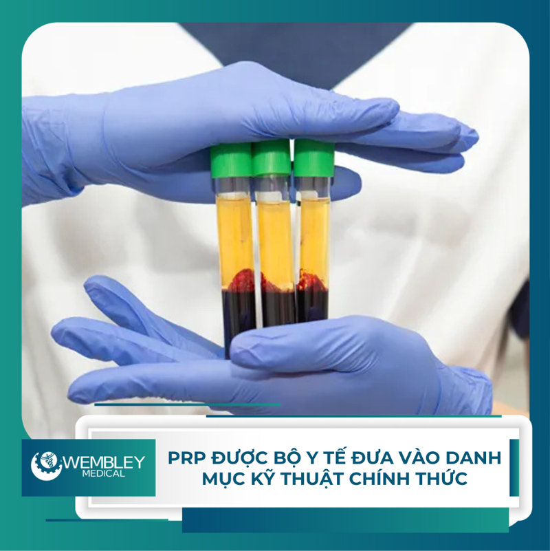 PRP – A Modern Treatment Trend Officially Included in the Ministry of Health of Vietnam’s Technical List