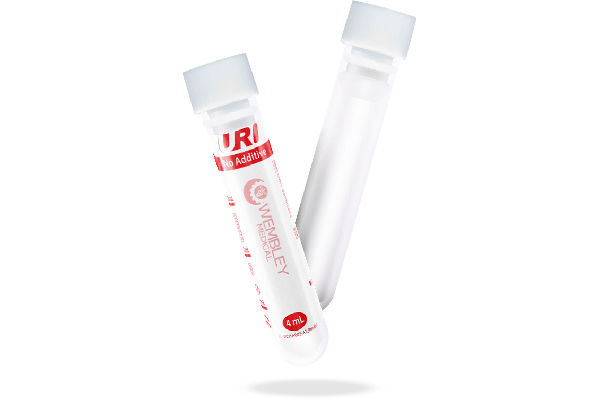 Ống Nghiệm Lấy Mẫu Không Hóa Chất URI