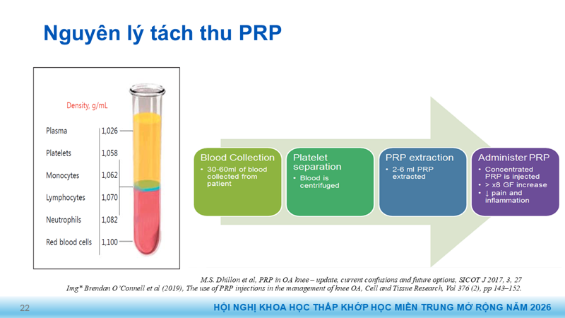 Presentation: Application of PRP in the Treatment of Tendinitis