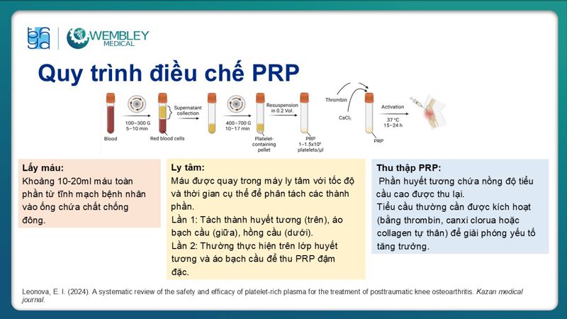 Bài báo cáo: Vai trò của PRP trong điều trị thoái hóa khớp